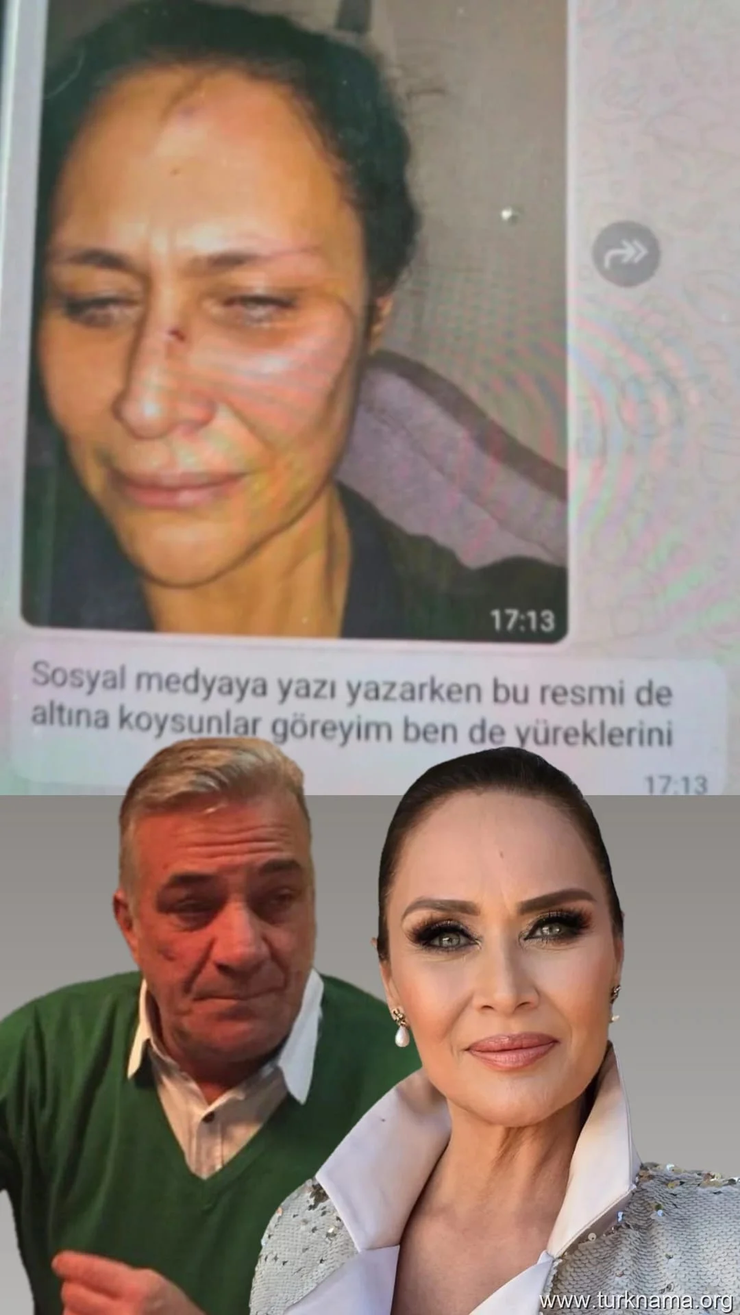 نسلیهان آجار (Neslihan Acar) سکوت را شکست: اتهامات جدید خشونت خانگی علیه لونت اینانیر (Levent İnanır) و افشای شواهد تکان دهنده 1 عکس خبر